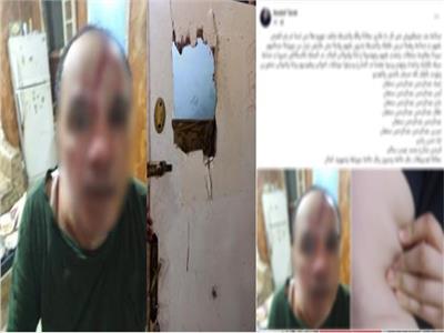 كسروا الأبواب واعتدوا على الجميع.. تفاصيل مثيرة لاقتحام منزل بالغربية أخبار مصر - كسروا الأبواب واعتدوا على الجميع.. تفاصيل مثيرة لاقتحام منزل بالغربية