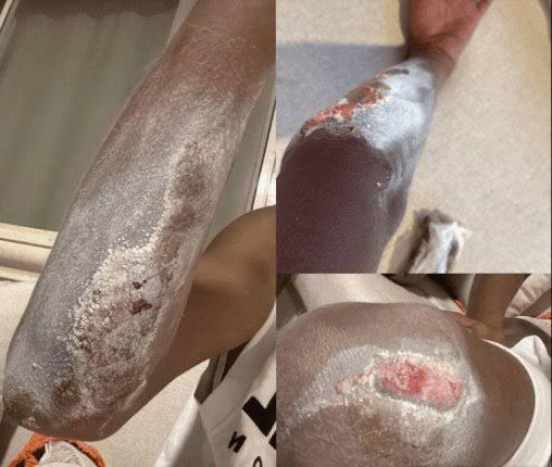 محطة مصر نيوز - عصام صاصا يكشف عن إصابته بجرح في يده ويطمئن جمهوره