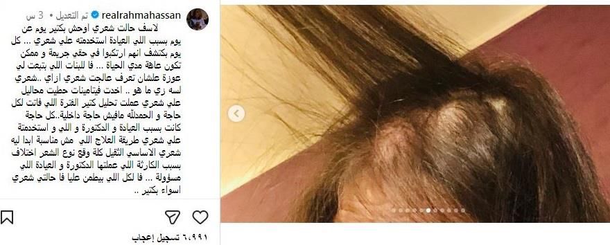 محطة مصر نيوز - رحمة حسن تكشف تدهور حالتها الصحية بسبب خطأ طبي وتطمئن جمهورها برسالة صادقة