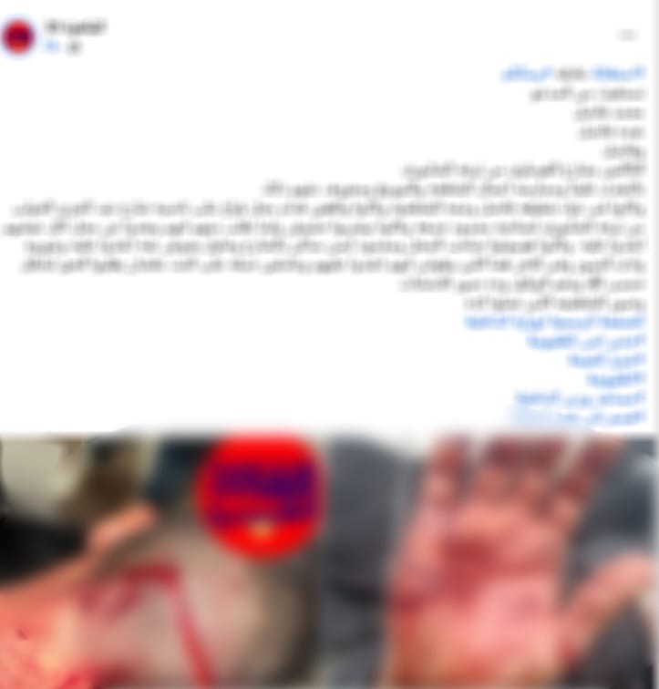 أخبار مصر والعالم لحظة بلحظة - منشور كاذب يكشف الحقيقة.. ضبط طرفي مشاجرة مسلحة في شبرا الخيمة
