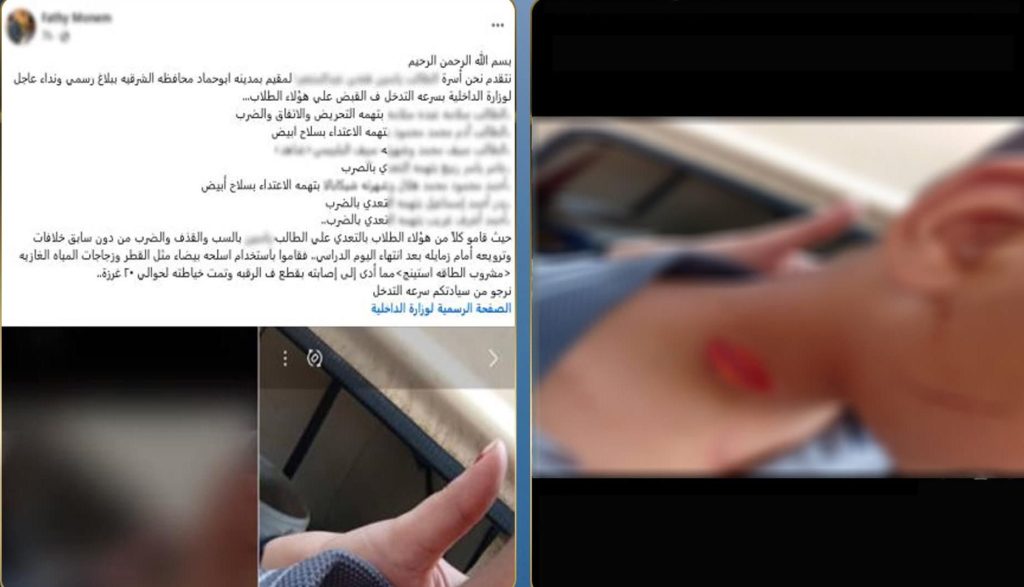 محطة مصر نيوز - مشاجرة طلابية تنتهي بإصابة طالب بجرح في الرقبة في الشرقية