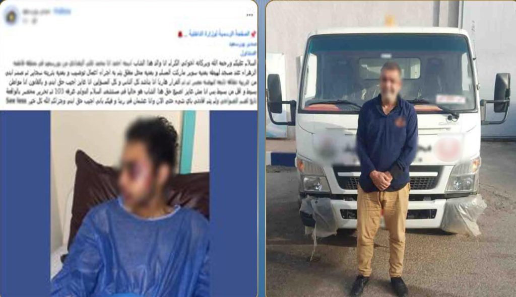 كشف ملابسات حادث دهس ببورسعيد.. وضبط سائق سيارة نقل متهم بالإصطدام بمواطن ولاذ بالفرار أخبار مصر والعالم لحظة بلحظة - كشف ملابسات حادث دهس ببورسعيد.. وضبط سائق سيارة نقل متهم بالإصطدام بمواطن ولاذ بالفرار