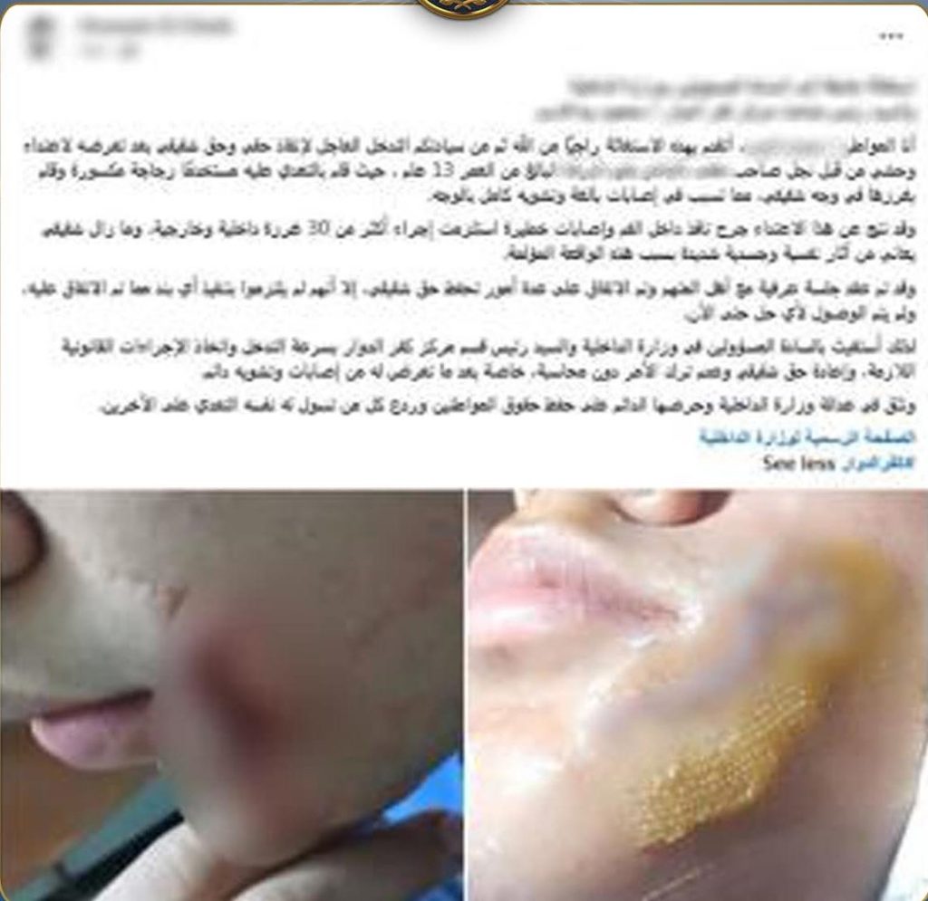 خلاف لعب أطفال يتحول لمشاجرة دامية.. طالب يُصيب زميله بقطعة زجاج في البحيرة أخبار مصر والعالم لحظة بلحظة - خلاف لعب أطفال يتحول لمشاجرة دامية.. طالب يُصيب زميله بقطعة زجاج في البحيرة