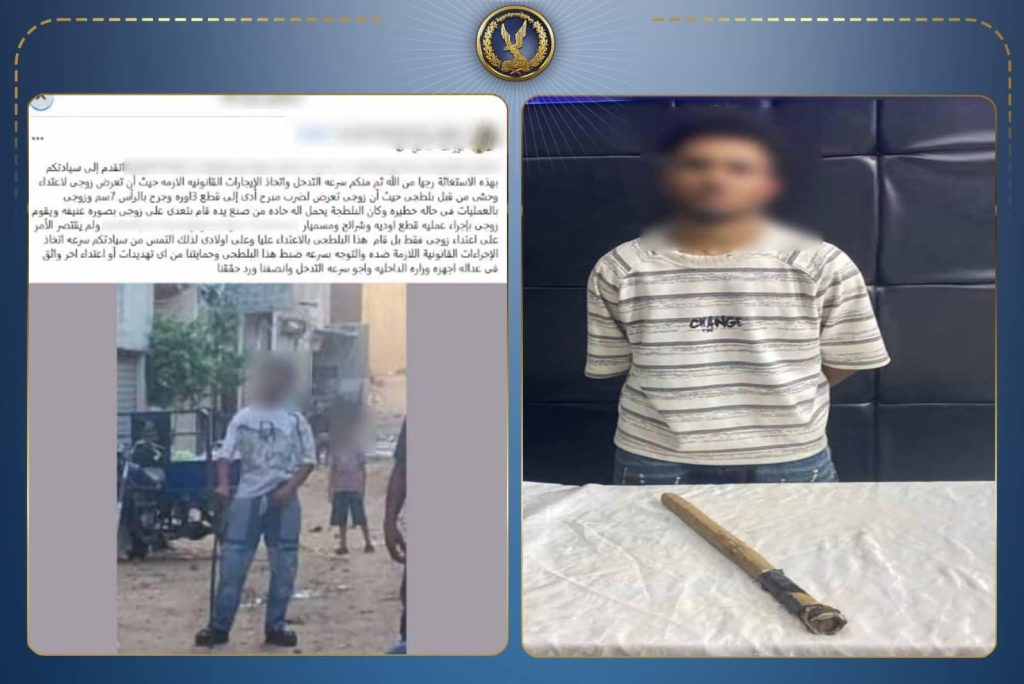 خلاف بسبب لعب الأطفال ينتهي بإصابة عامل بكسر في يده بمدينة نصر أخبار مصر - خلاف بسبب لعب الأطفال ينتهي بإصابة عامل بكسر في يده بمدينة نصر