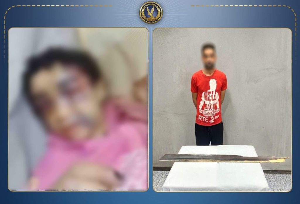 أخبار مصر - ضبط أب اعتدى على ابنته بالضرب وأصابها بكسور متعددة في الإسكندرية